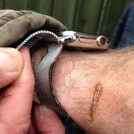 Apple Watch brændte min arm 5