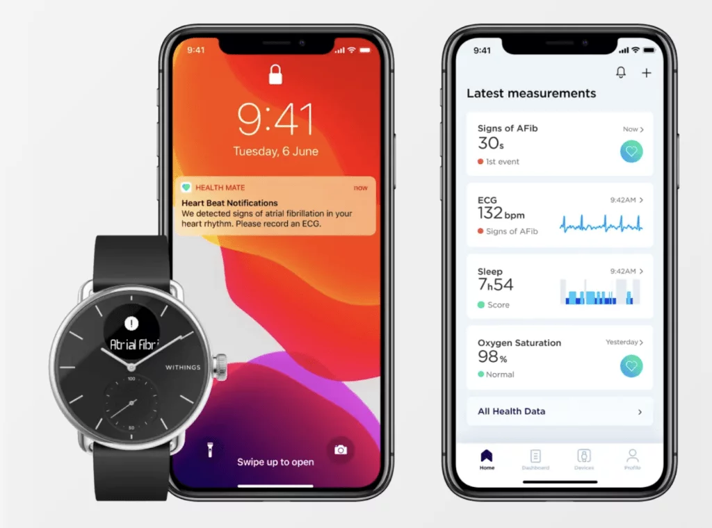 ScanWatch i forskellige varianter (Foto: ScanWatch)