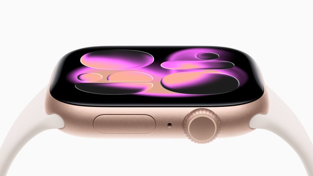 Apple Watch Series 11 (Foto: Apple)