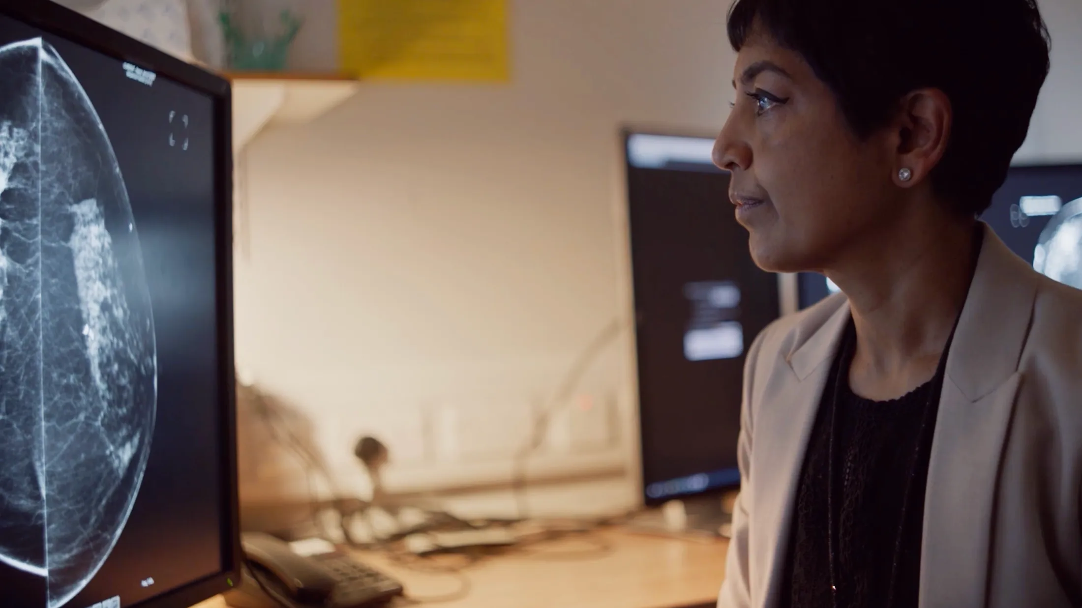 Mammografi-screening analyseret med Google AI kunstig intelligens